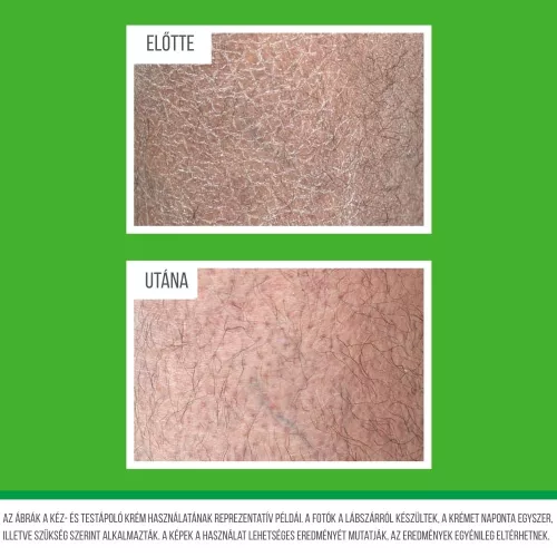 OKeeffes Working Hands Hand & Body Lotion Hidratáló kéz és testápoló krém száraz, repedezett bőrre 315 ml